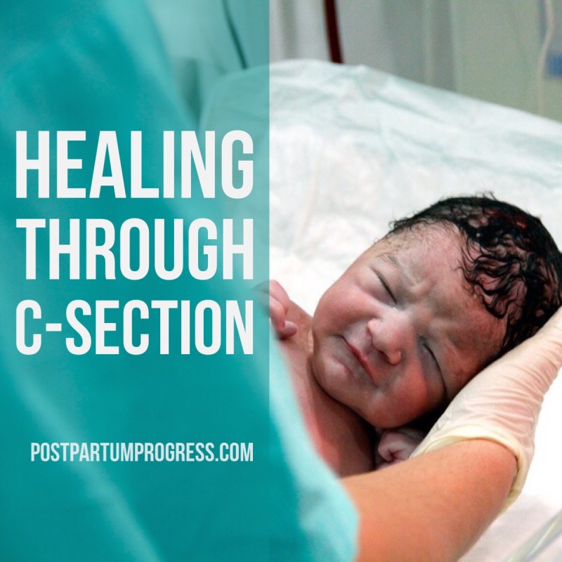 Healing Through C-Section -postpartumprogress.com Healing Through C-Section -postpartumprogress.com